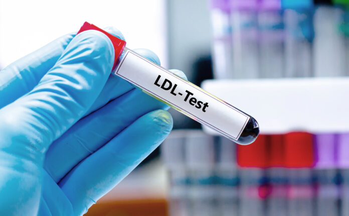 20260408 LDL